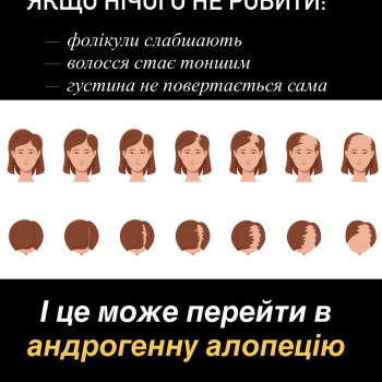 Фото с портфолио Анна Коваль