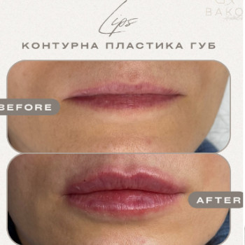 Фото с портфолио BAKO Aesthetics