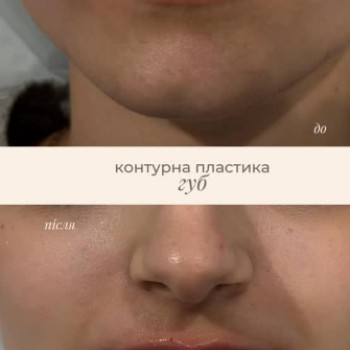 Фото с портфолио Body Shine