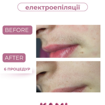 Фото с портфолио Kami Epil