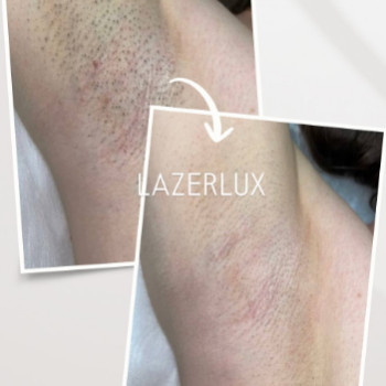 Фото с портфолио Lazerlux