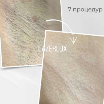 Фото с портфолио Lazerlux