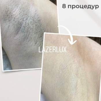 Фото с портфолио Lazerlux