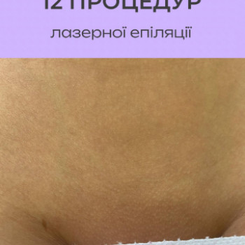 Фото с портфолио Lazerlux