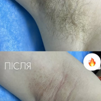 Фото с портфолио Сніжана 