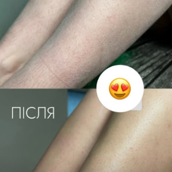 Фото с портфолио Сніжана 