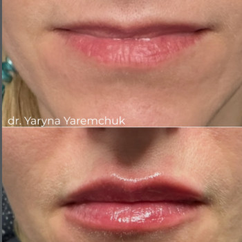 Фото с портфолио Dr. Yaremchuk Clinic