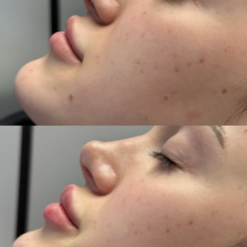 Фото с портфолио Dr. Yaremchuk Clinic
