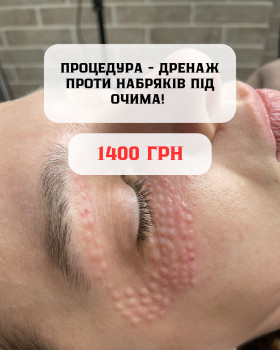Perfect Skin
