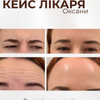 Фото с портфолио Lutsyk Aesthetic