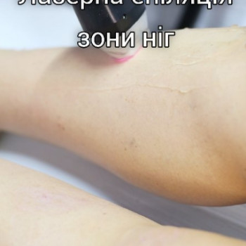 Фото с портфолио Silk Skin