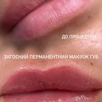 Губи до та загоєні після перманентного макіяжу