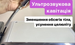 Апаратна корекція контурів тіла та зниження ваги Косметолог-инъекционист Светлана Сумы
