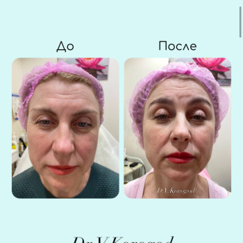 Фото с портфолио Вікторія Корн