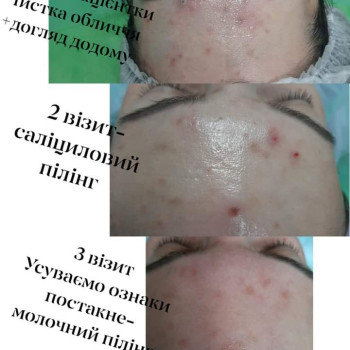 Фото с портфолио Катерина Клебан