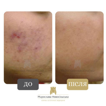 Фото с портфолио Клініка естетичної медицини Мирослави Новосільської