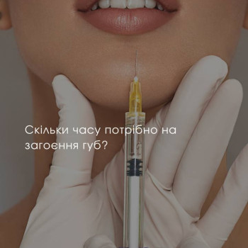 16. ВІКТОРИНА Найчастіші запитання про більшення губ 1 У дівчат є багато запитань про процедуру збільшення губ. Давайте разом спробуємо відповісти на них? Цікаво Спробуємо 2 Чи зможете ви вивести філлер, якщо вам не сподобається? Можна Не можна 3 Під час збільшення губ можна використовувати знеболююче? Можна Не можна 4 Після збільшення губ потрібен спеціальний догляд за губами? Можна Не можна 5 Після процедури краще добу не пити та палити? Правда Не правда 6 Після про