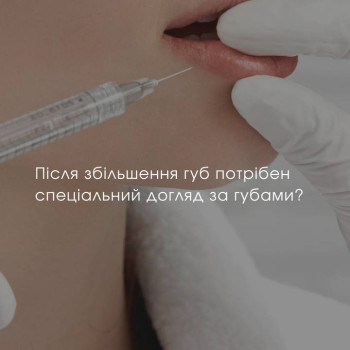 Фото с портфолио Екатерина Стельмашенко