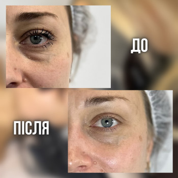 Фото с портфолио Chocolate Beauty Club