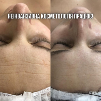 Фото с портфолио Chocolate Beauty Club