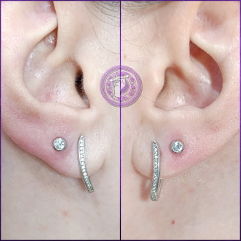 Фото с портфолио ilento + Piercing Point