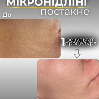 Фото с портфолио Excellence