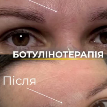 Фото с портфолио Excellence
