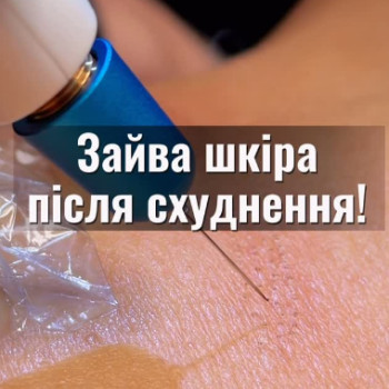 Фото с портфолио Мар'яна Салаш