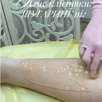 Фото с портфолио Only Sugaring