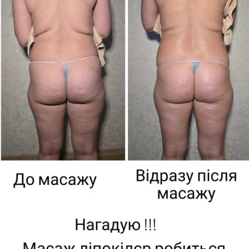 Один сеанс