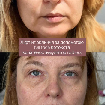 Фото с портфолио Наталі Брелінська