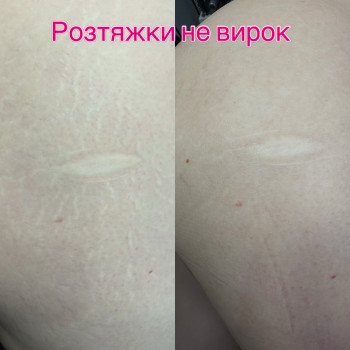 Фото с портфолио Алина Коломоец