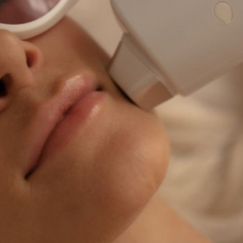 Фото с портфолио Lav Laser