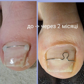 Фото с портфолио Ярина Кошик