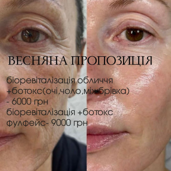 Фото с портфолио Євгенія Мельниченко