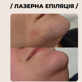 Фото с портфолио Laser Zona