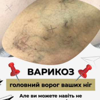 Фото с портфолио Мед Сіті