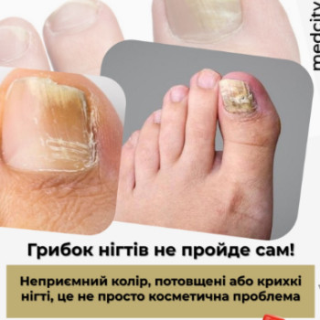 Фото с портфолио Мед Сіті