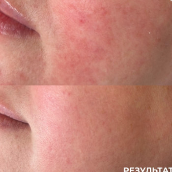 Фото с портфолио Laser Care Clinic