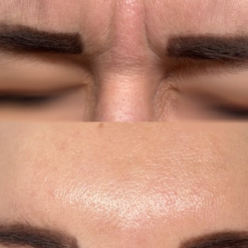 Фото с портфолио Laser Care Clinic
