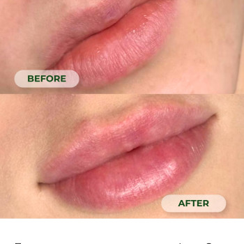 Фото с портфолио Laser Care Clinic