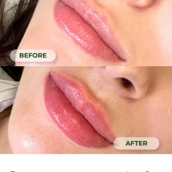 Фото с портфолио Laser Care Clinic