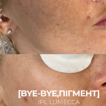 Фото с портфолио DK Beauty Clinic