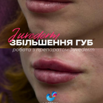 Фото с портфолио LAZERINI