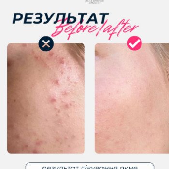 Фото с портфолио Клініка естетичної медицини LAZERINI