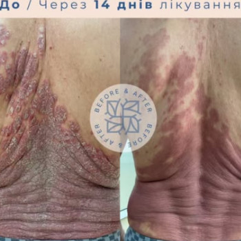 Фото с портфолио Levanchuk.Med