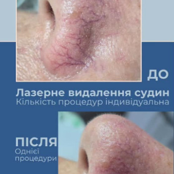 Фото с портфолио Levanchuk.Med