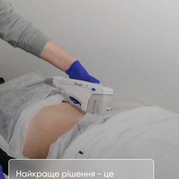 Фото с портфолио Медлайк