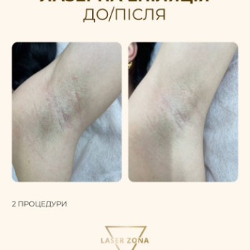 Фото с портфолио Laser Zona