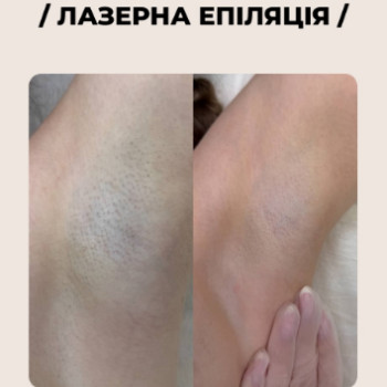 Фото с портфолио Laser Zona